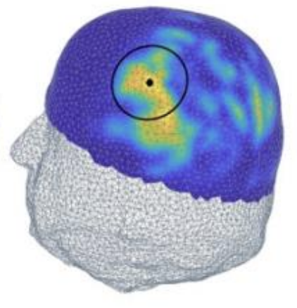 neuromodulation.png